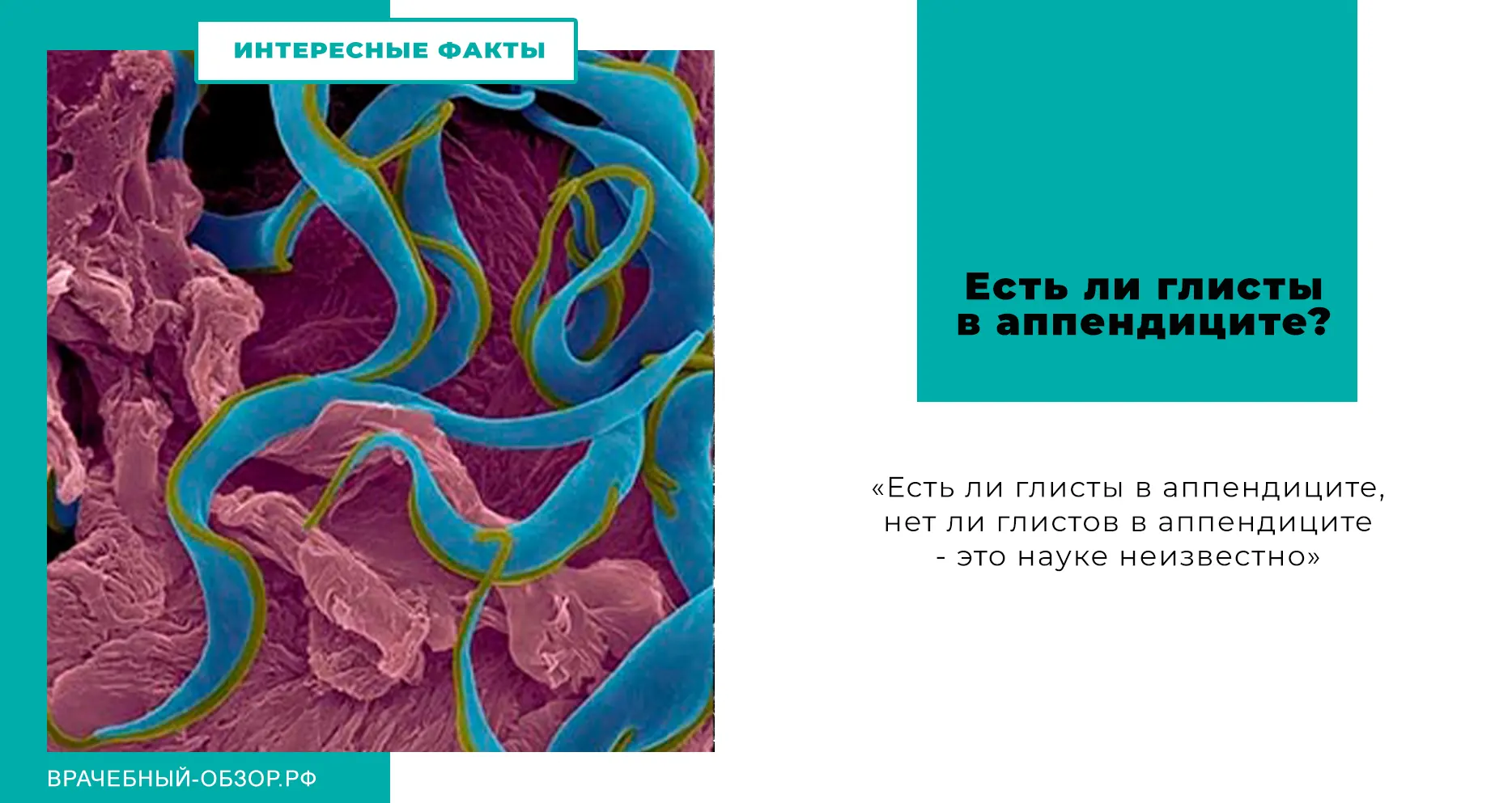 Есть ли глисты в аппендиците?