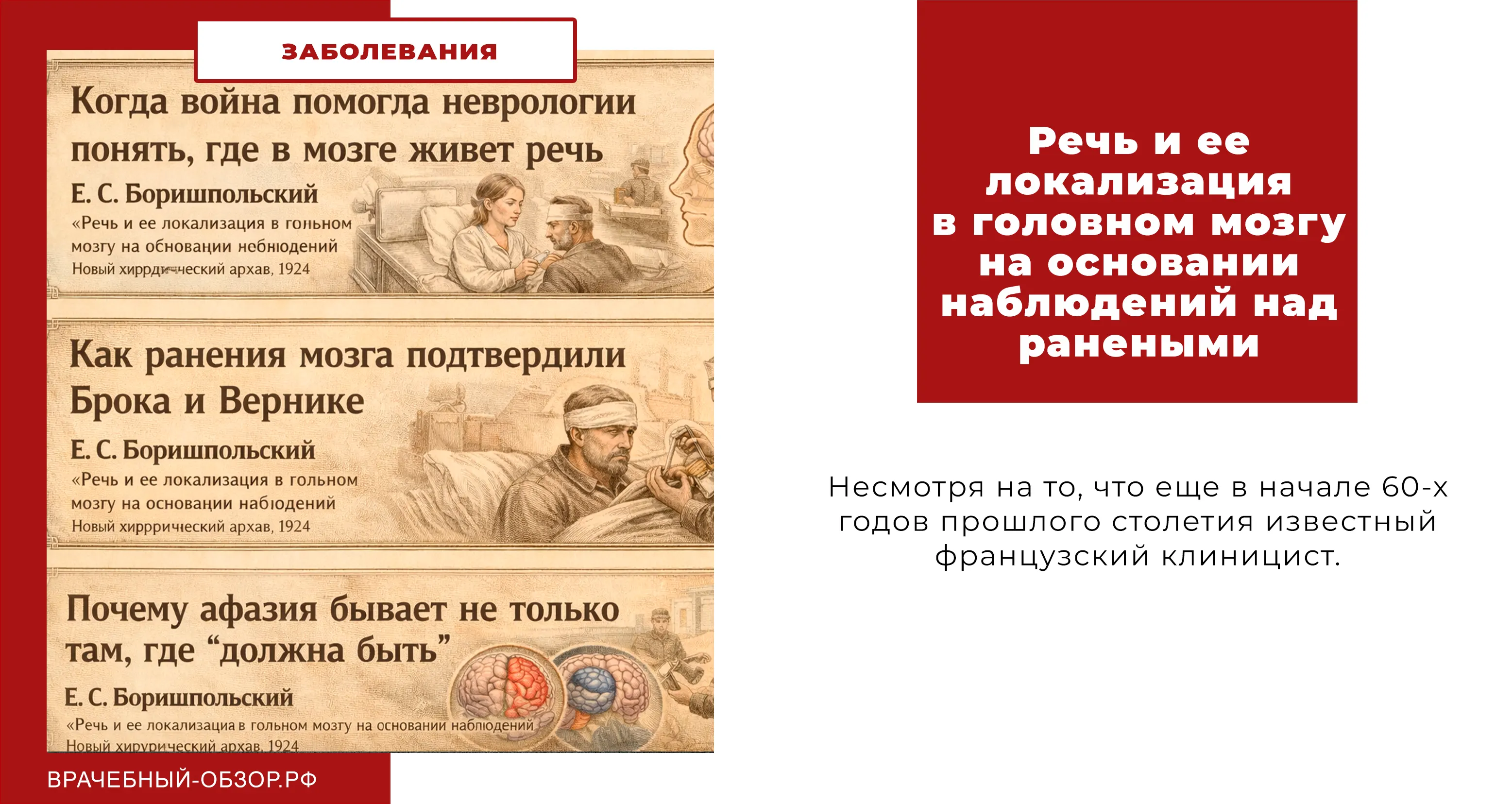 Речь и ее локализация в головном мозгу на основании наблюдений над ранеными