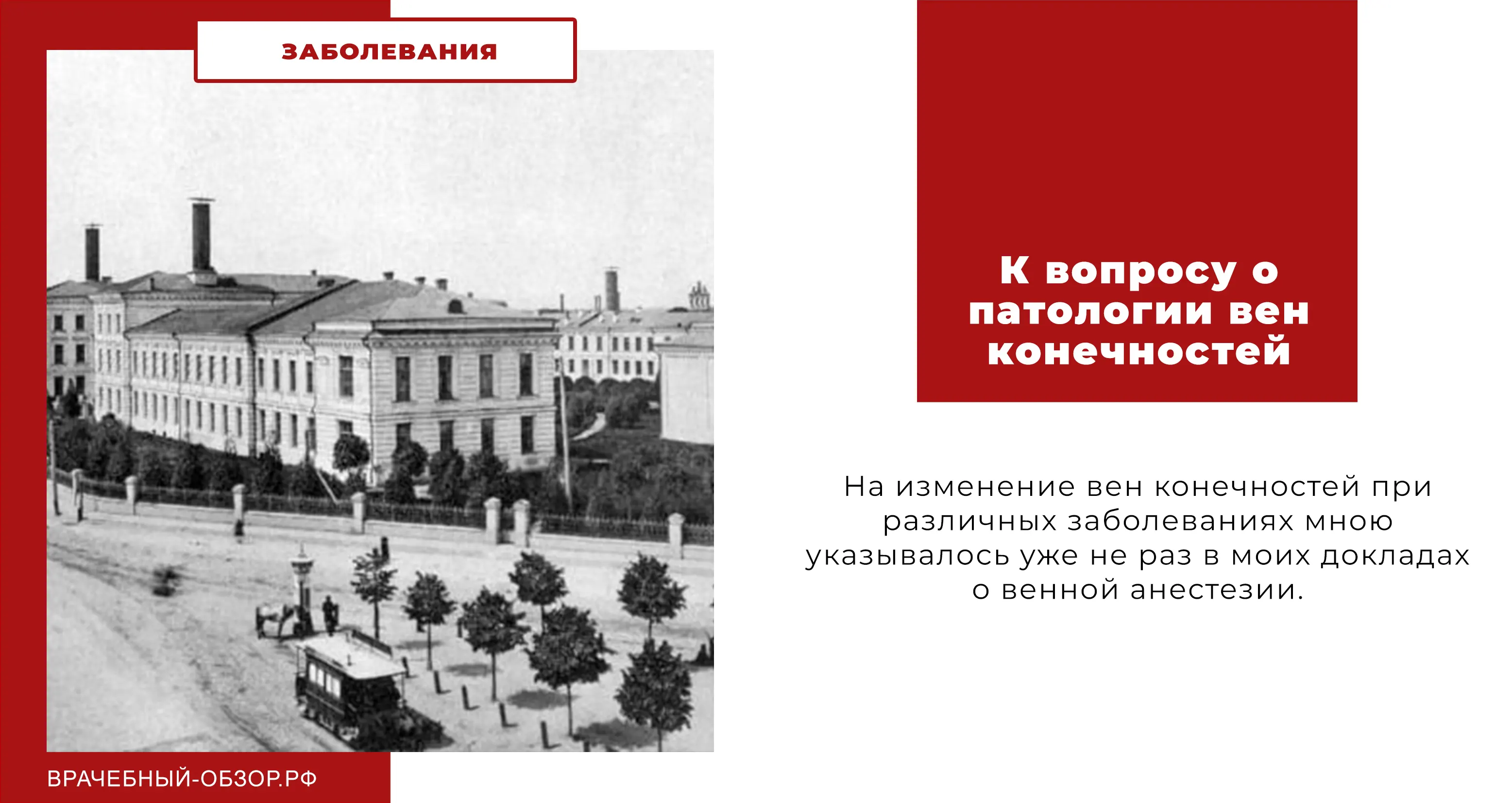 К вопросу о патологии вен конечностей