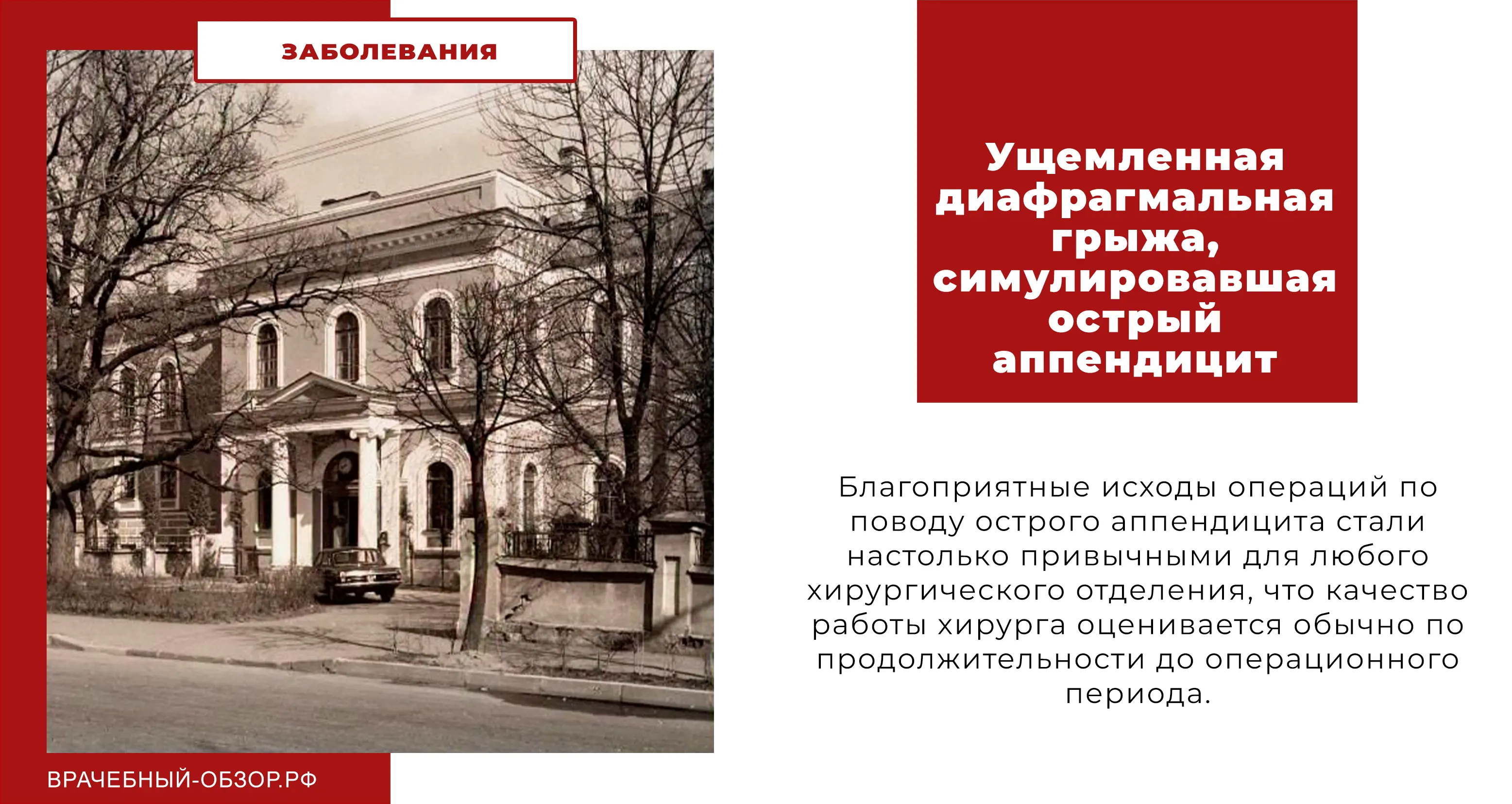 Ущемленная диафрагмальная грыжа, симулировавшая острый аппендицит
