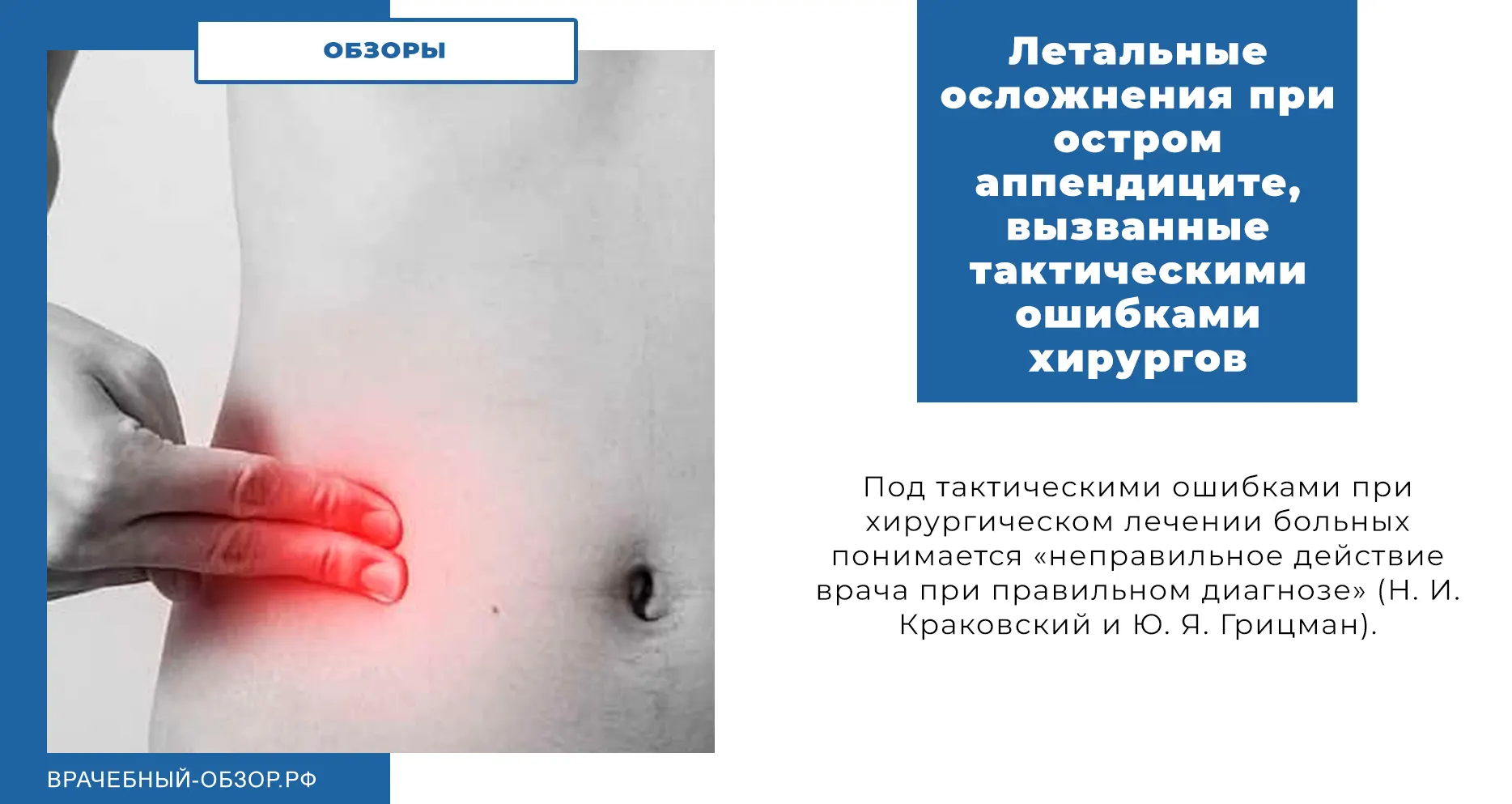 Летальные осложнения при остром аппендиците, вызванные тактическими ошибками хирургов