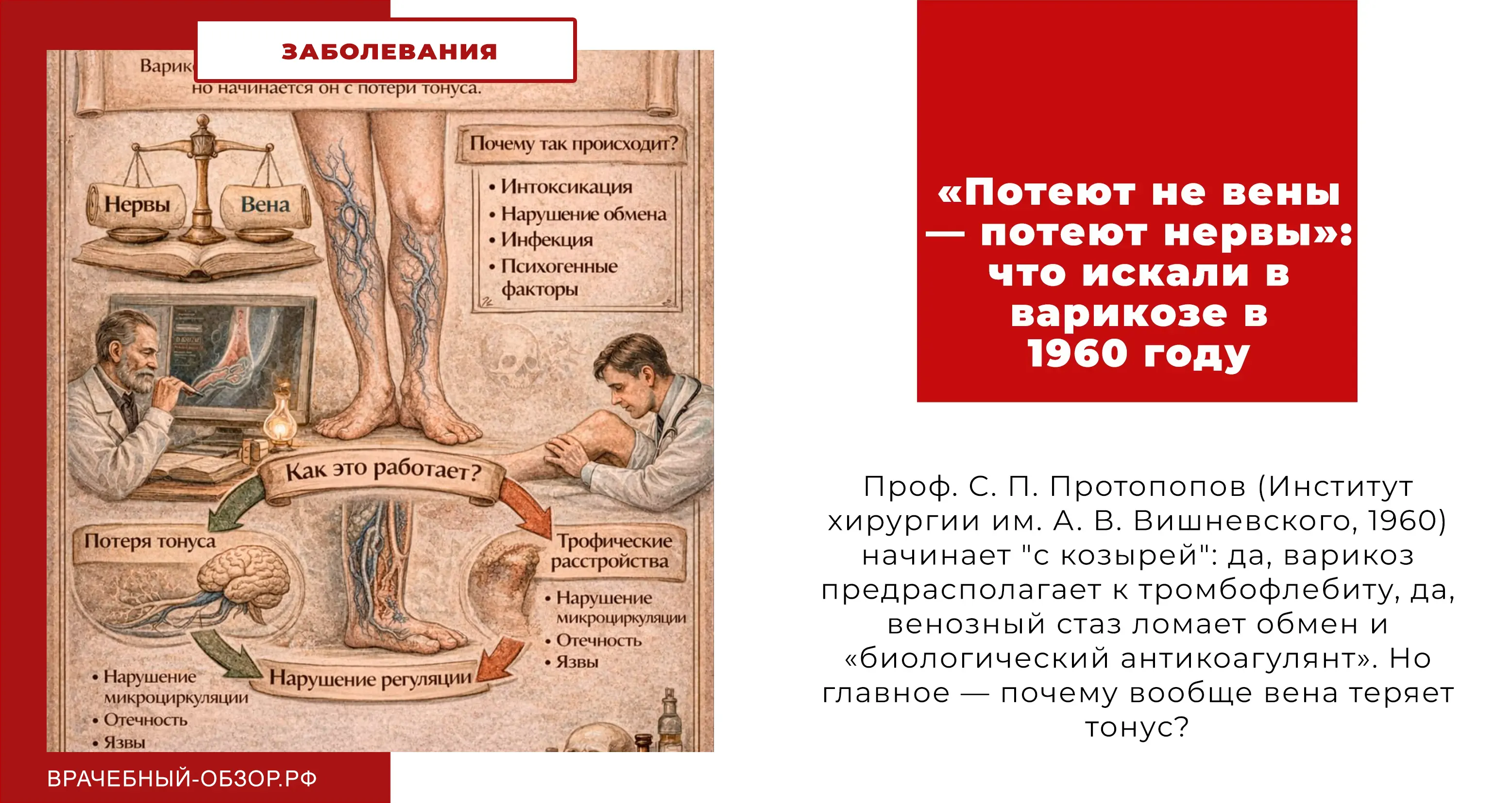 Нервный фактор в патогенезе варикозного расширения вен нижних конечностей