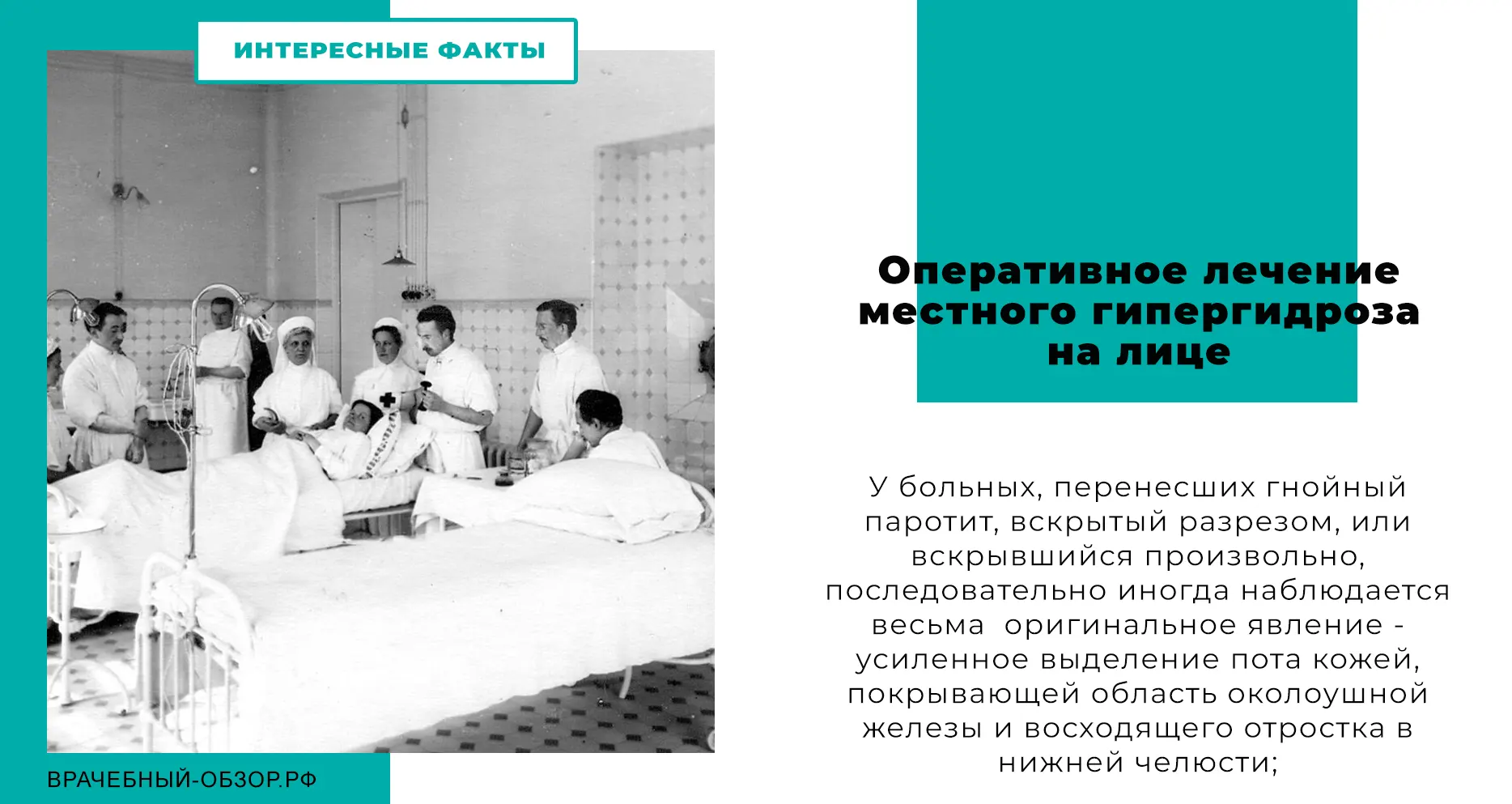 Оперативное лечение местного гипергидроза на лице