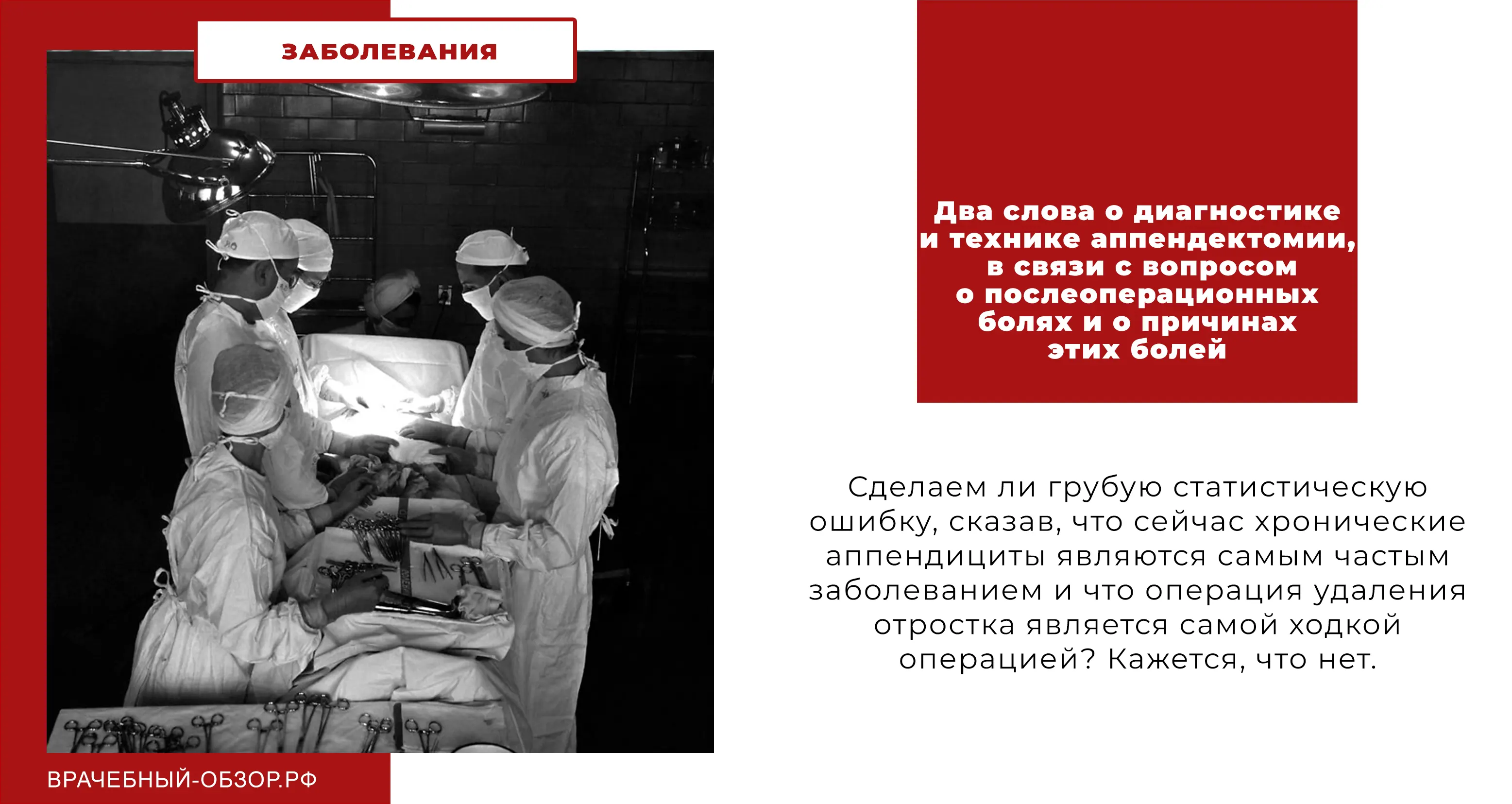 Два слова о диагностике и технике аппендектомии, в связи с вопросом о послеоперационных болях и о причинах этих болей