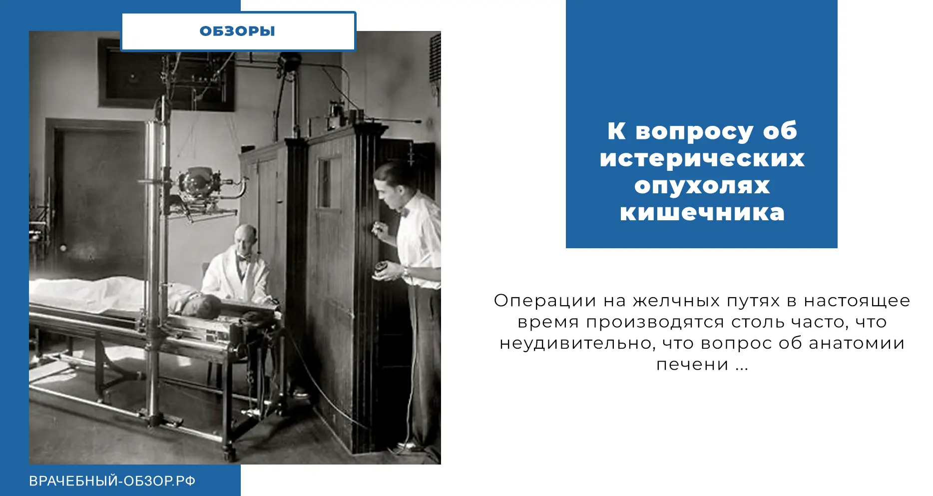 К вопросу об истерических опухолях кишечника