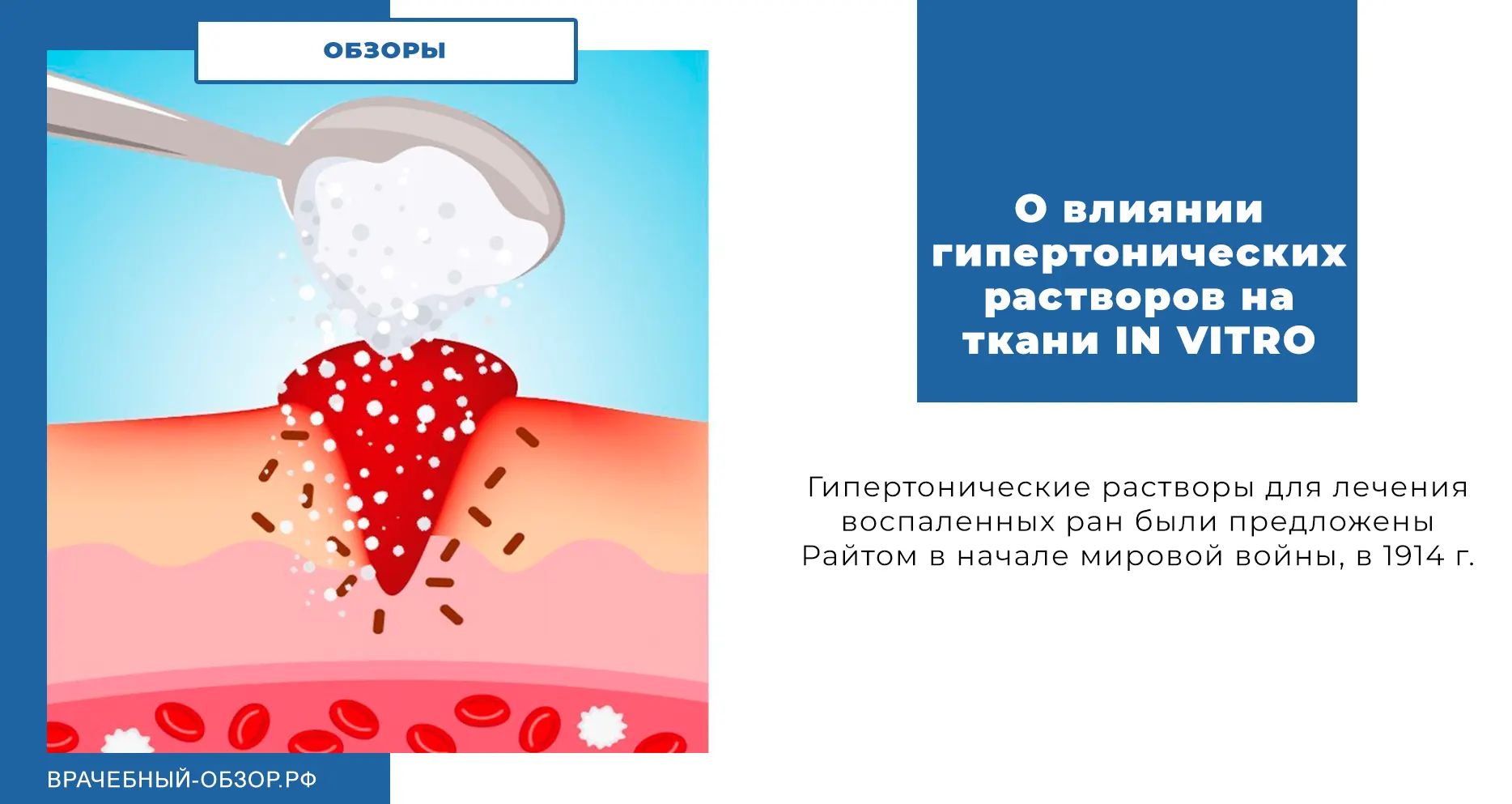 О влиянии гипертонических растворов на ткани IN VITRO
