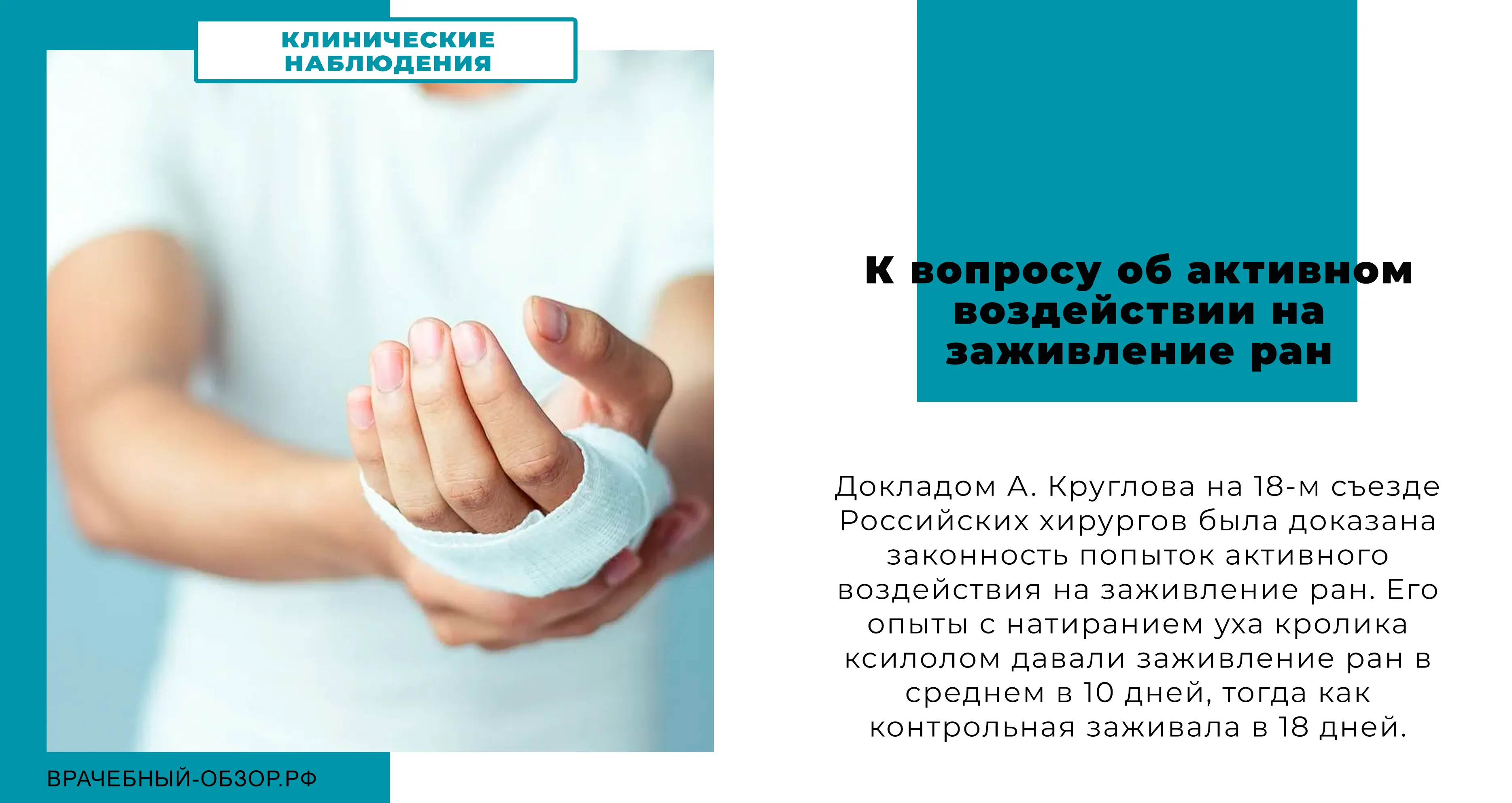 К вопросу об активном воздействии на заживление ран