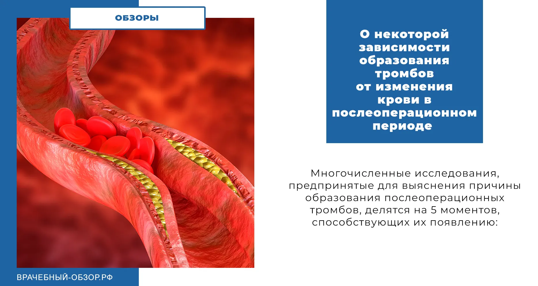 О некоторой зависимости образования тромбов от изменения крови в послеоперационном периоде