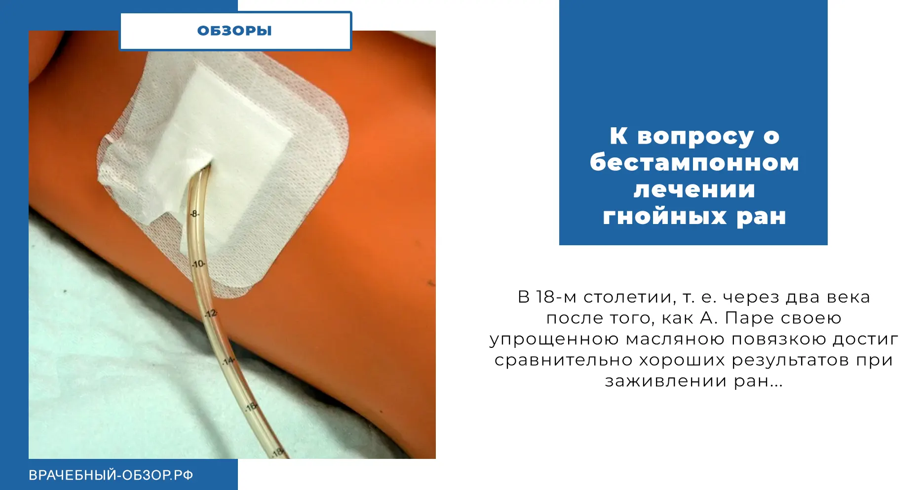 К вопросу о бестампонном лечении гнойных ран