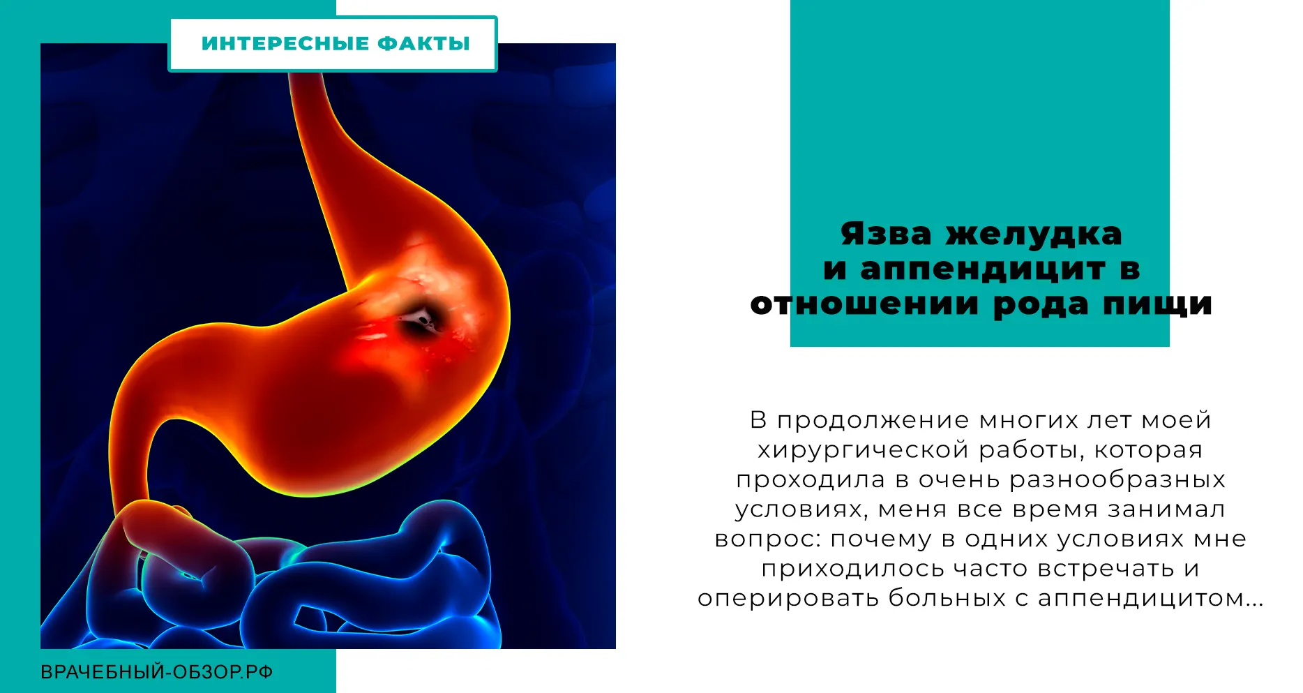 Язва желудка и аппендицит в отношении рода пищи