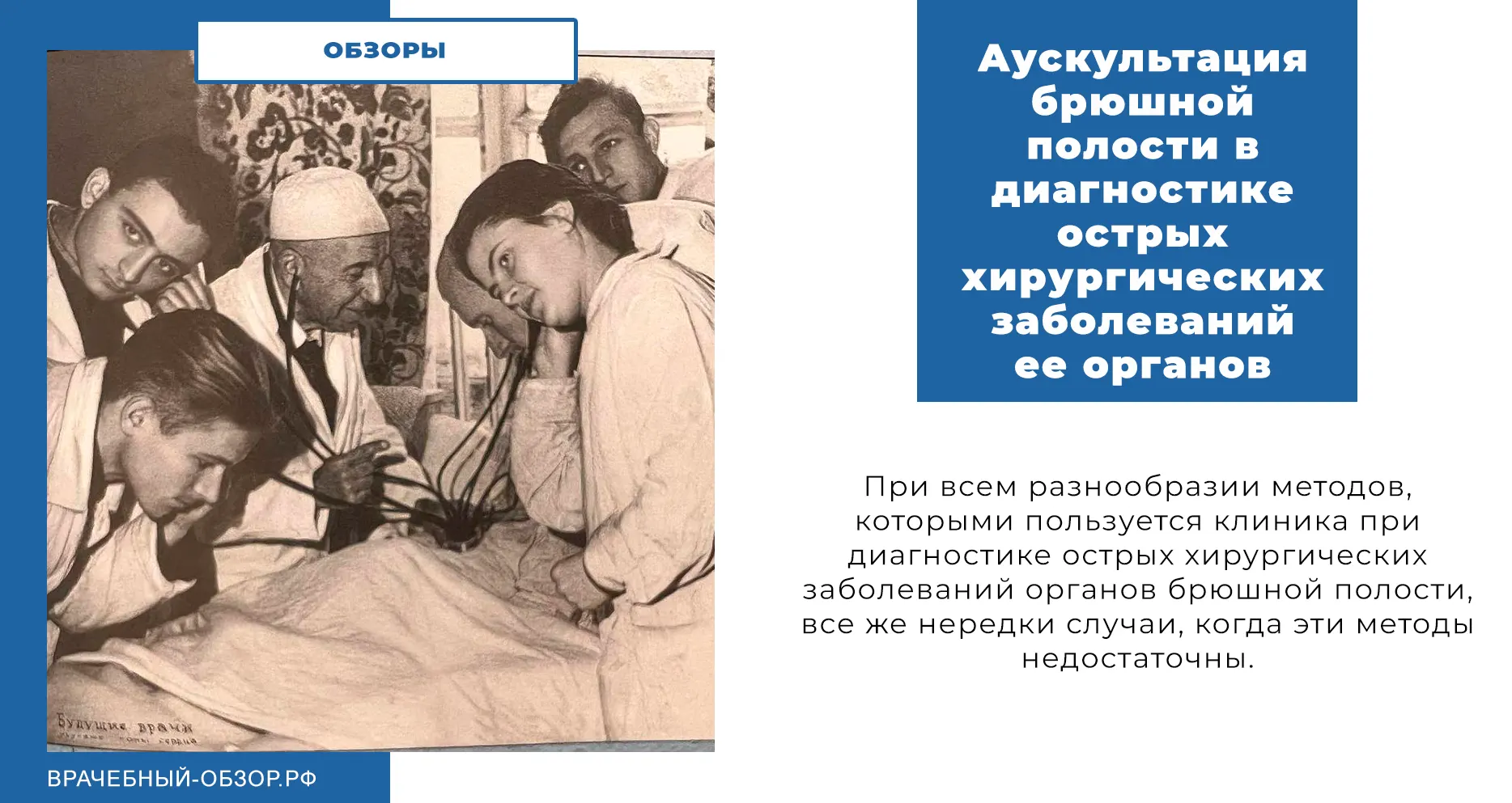 Аускультация брюшной полости в диагностике острых хирургических заболеваний ее органов