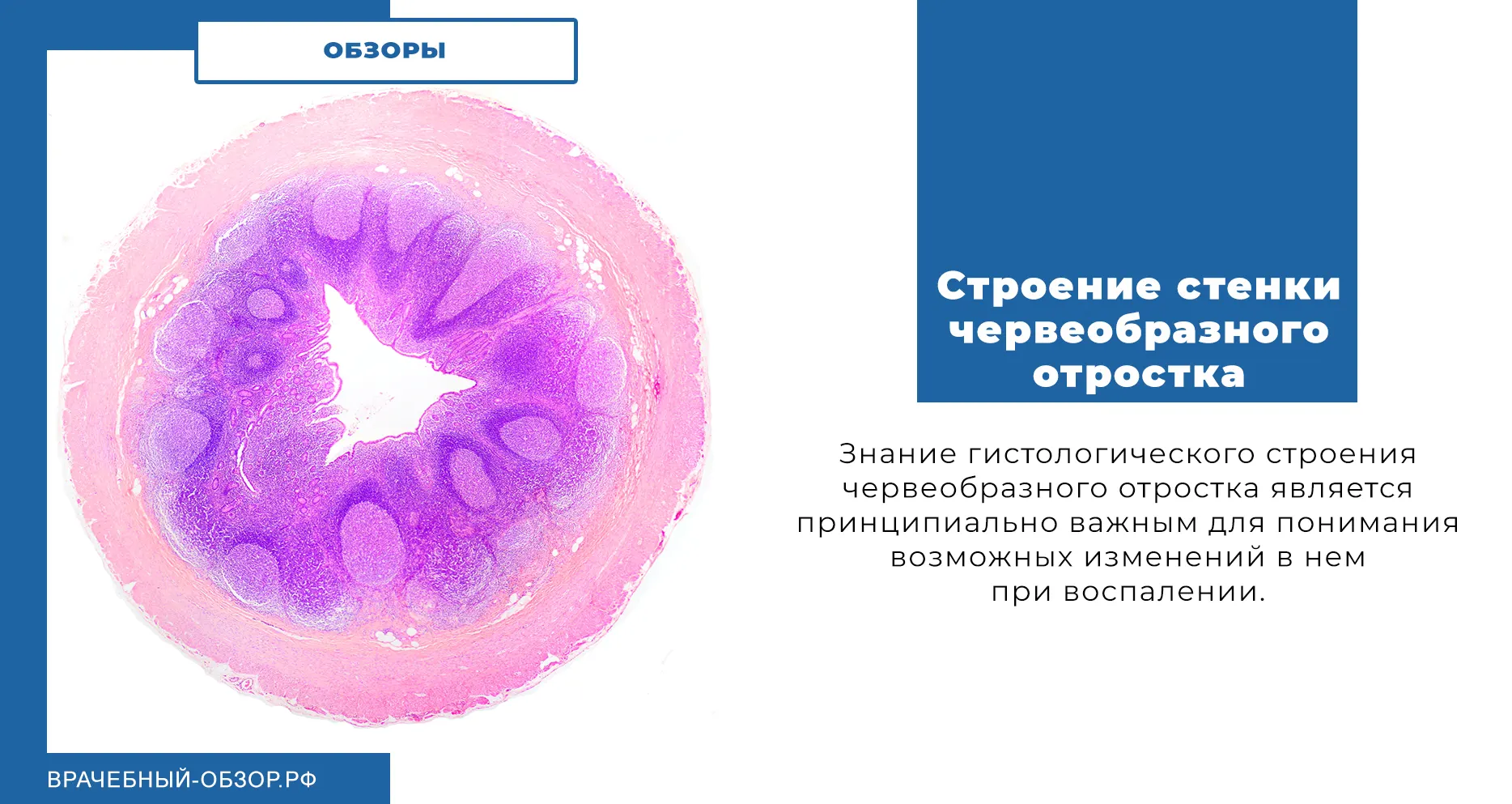Строение стенки червеобразного отростка