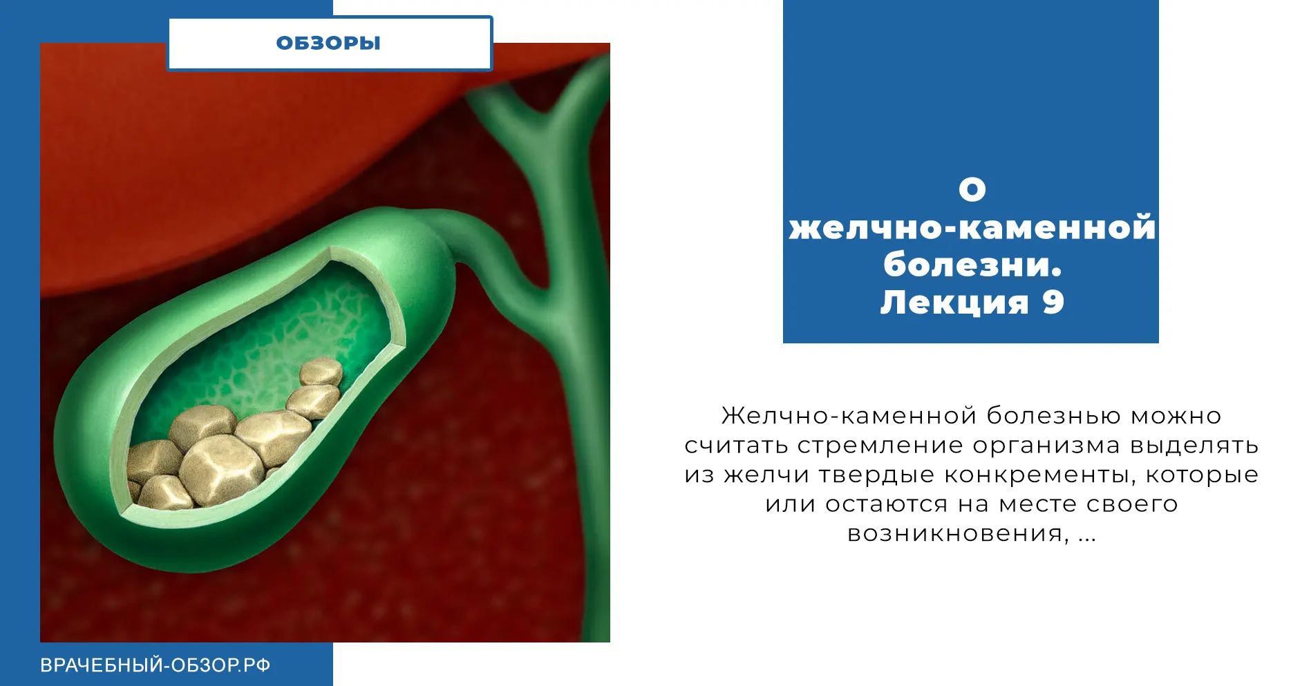 О желчно-каменной болезни. Лекция 9