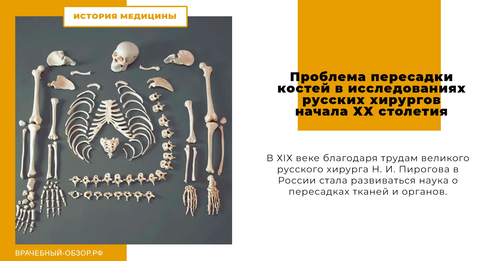 Проблема пересадки костей в исследованиях русских хирургов начала ХХ столетия