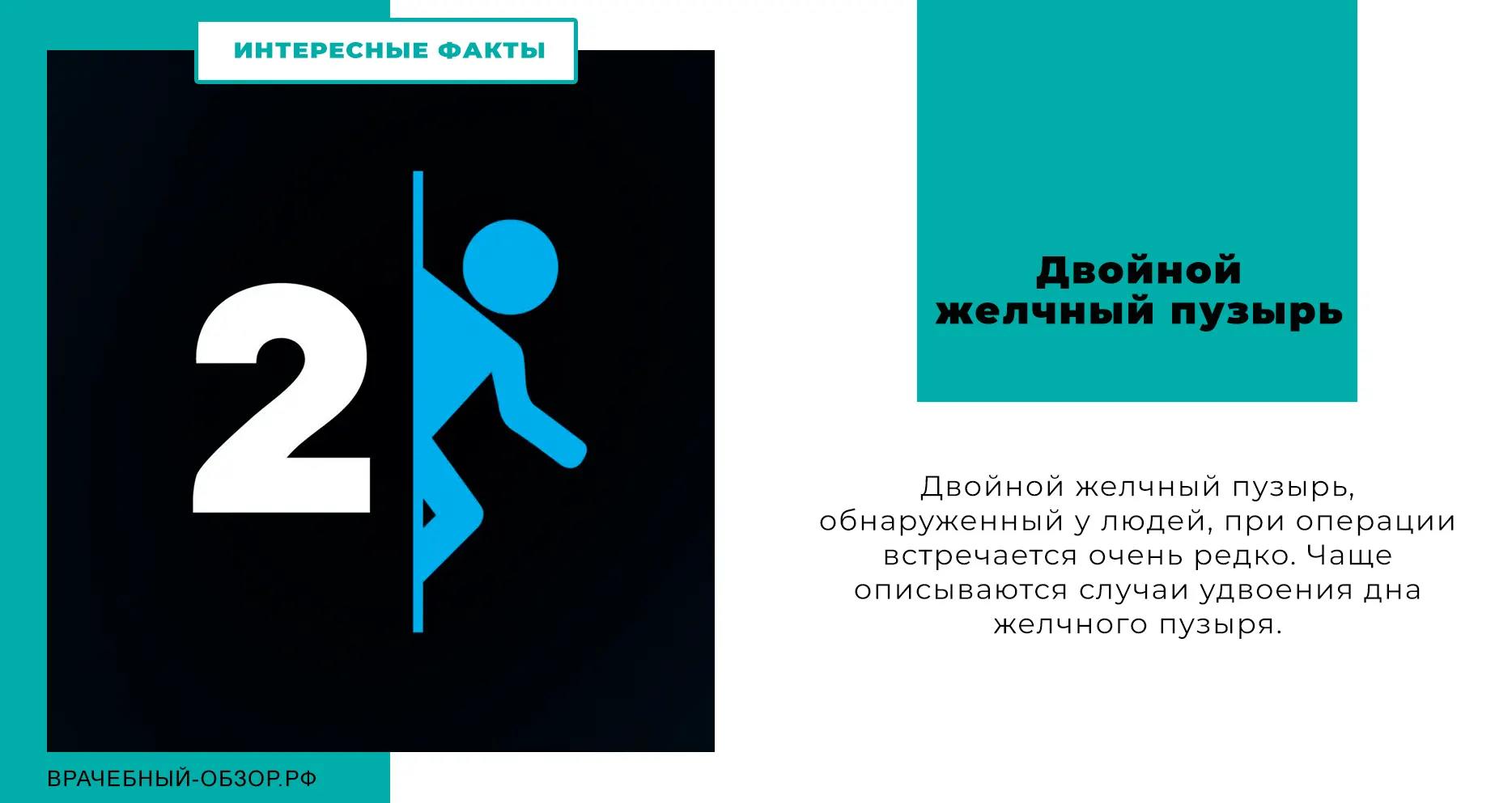 Двойной желчный пузырь