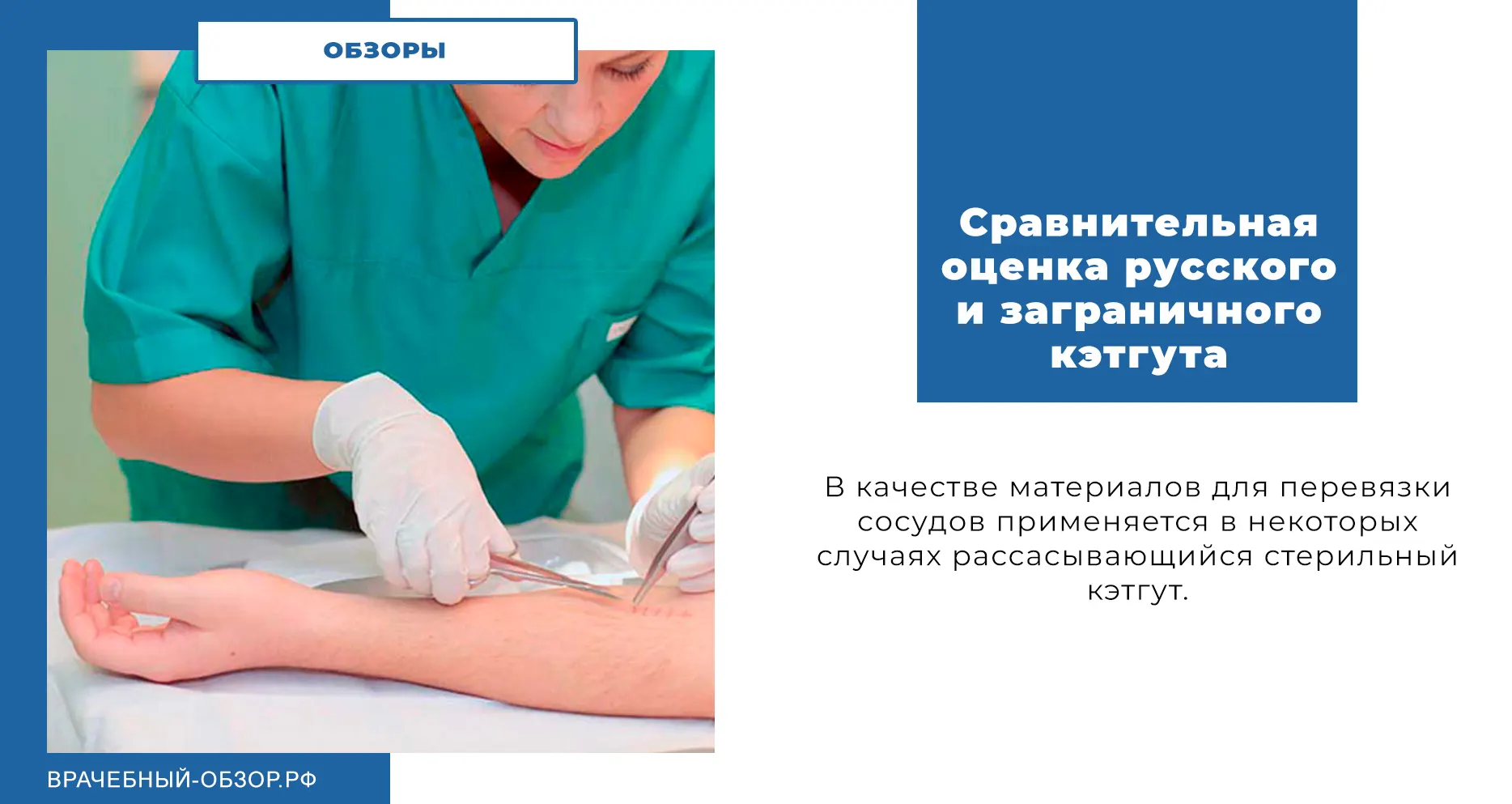 Сравнительная оценка русского и заграничного кэтгута