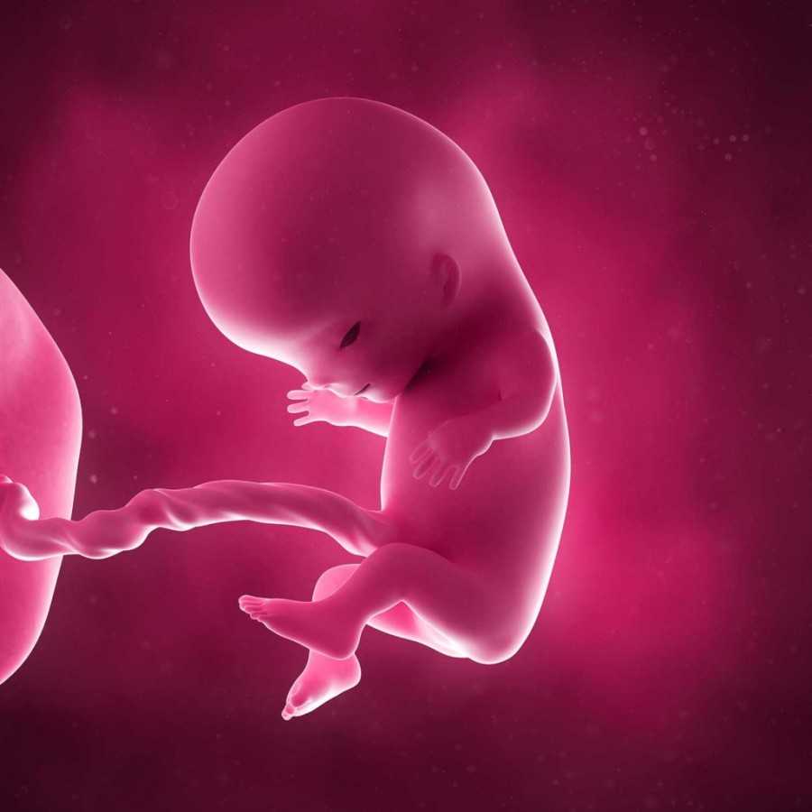 К казуистике уродств membri virilis