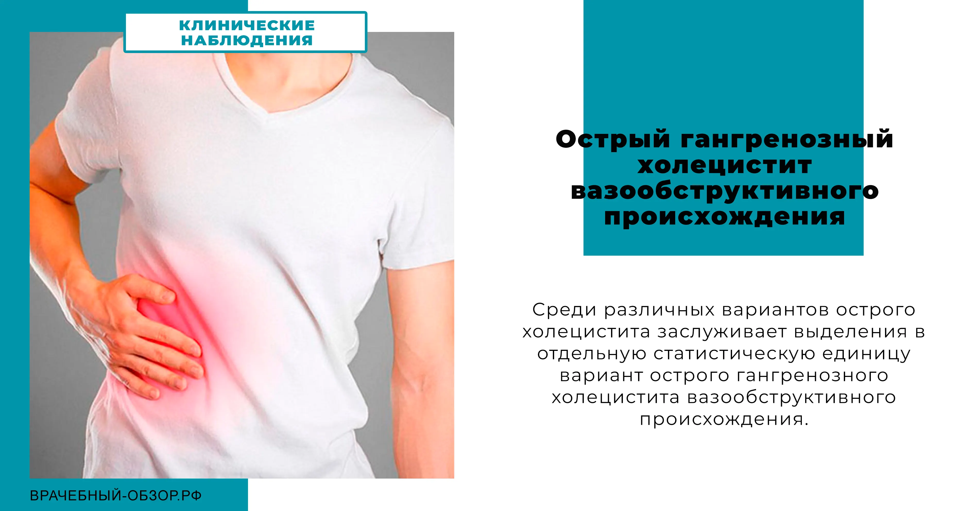 Острый гангренозный холецистит вазообструктивного происхождения