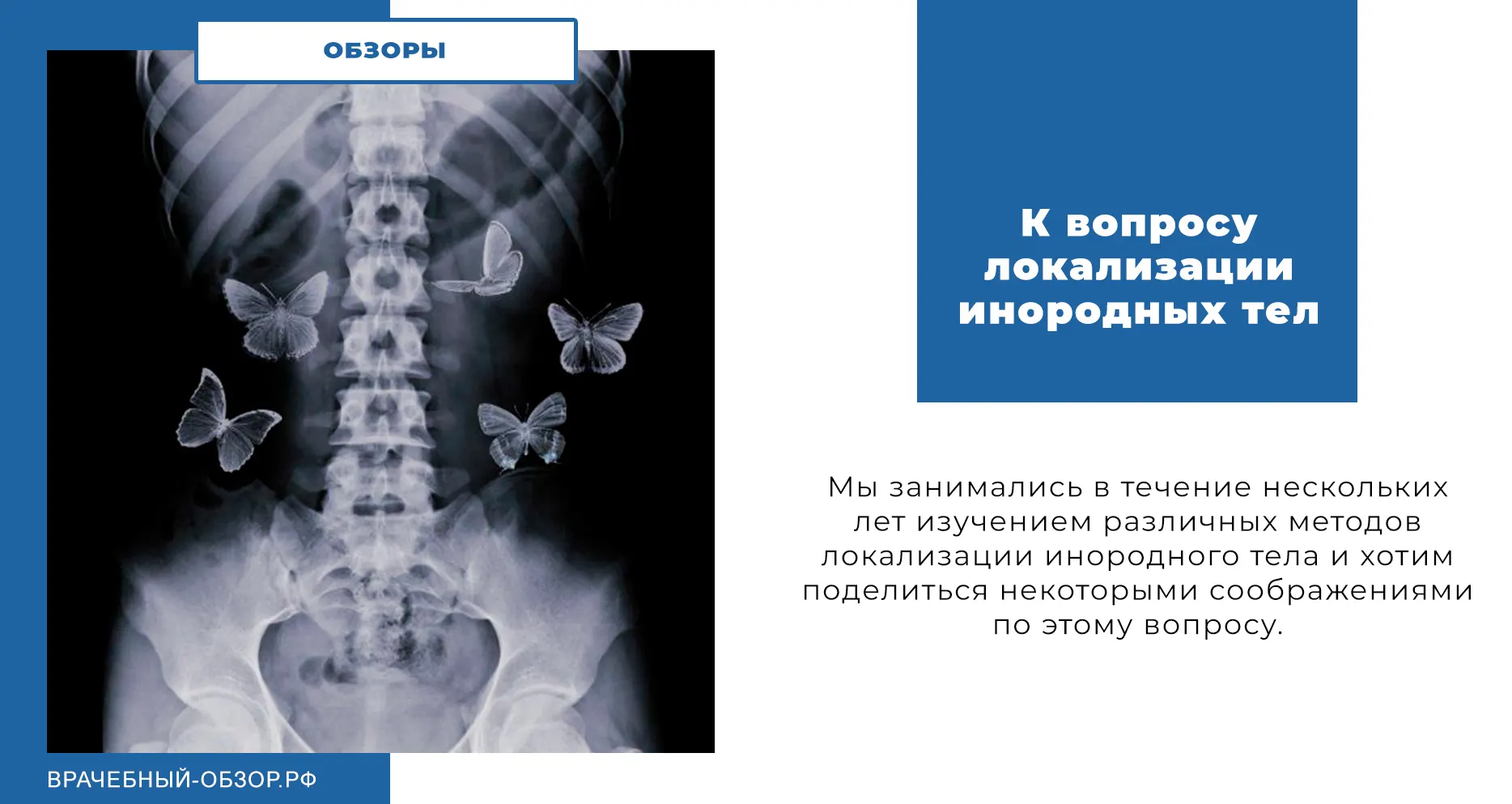 К вопросу локализации инородных тел