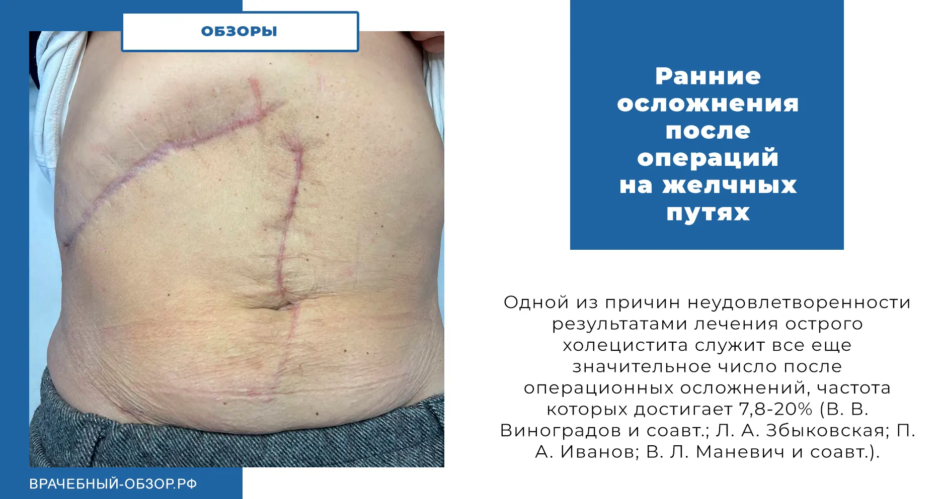 Ранние осложнения после операций на желчных путях