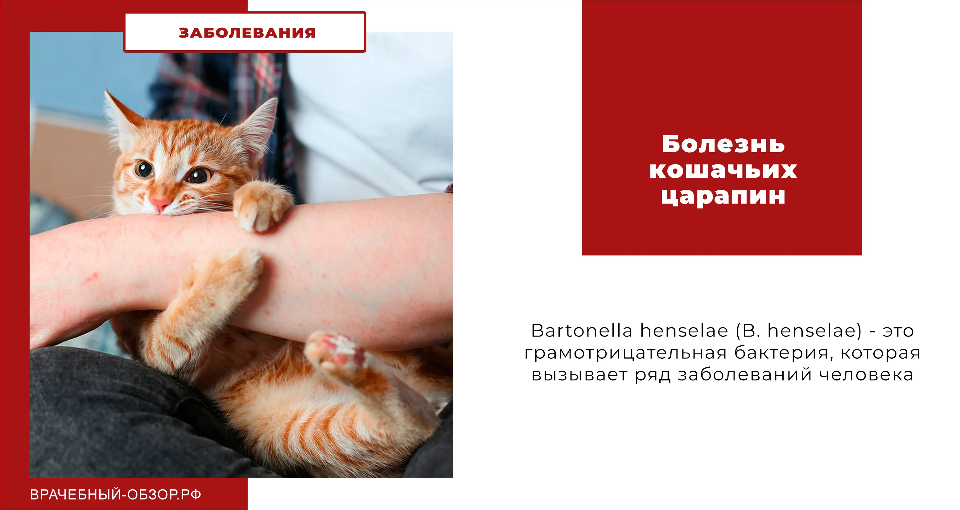 Болезнь кошачьих царапин