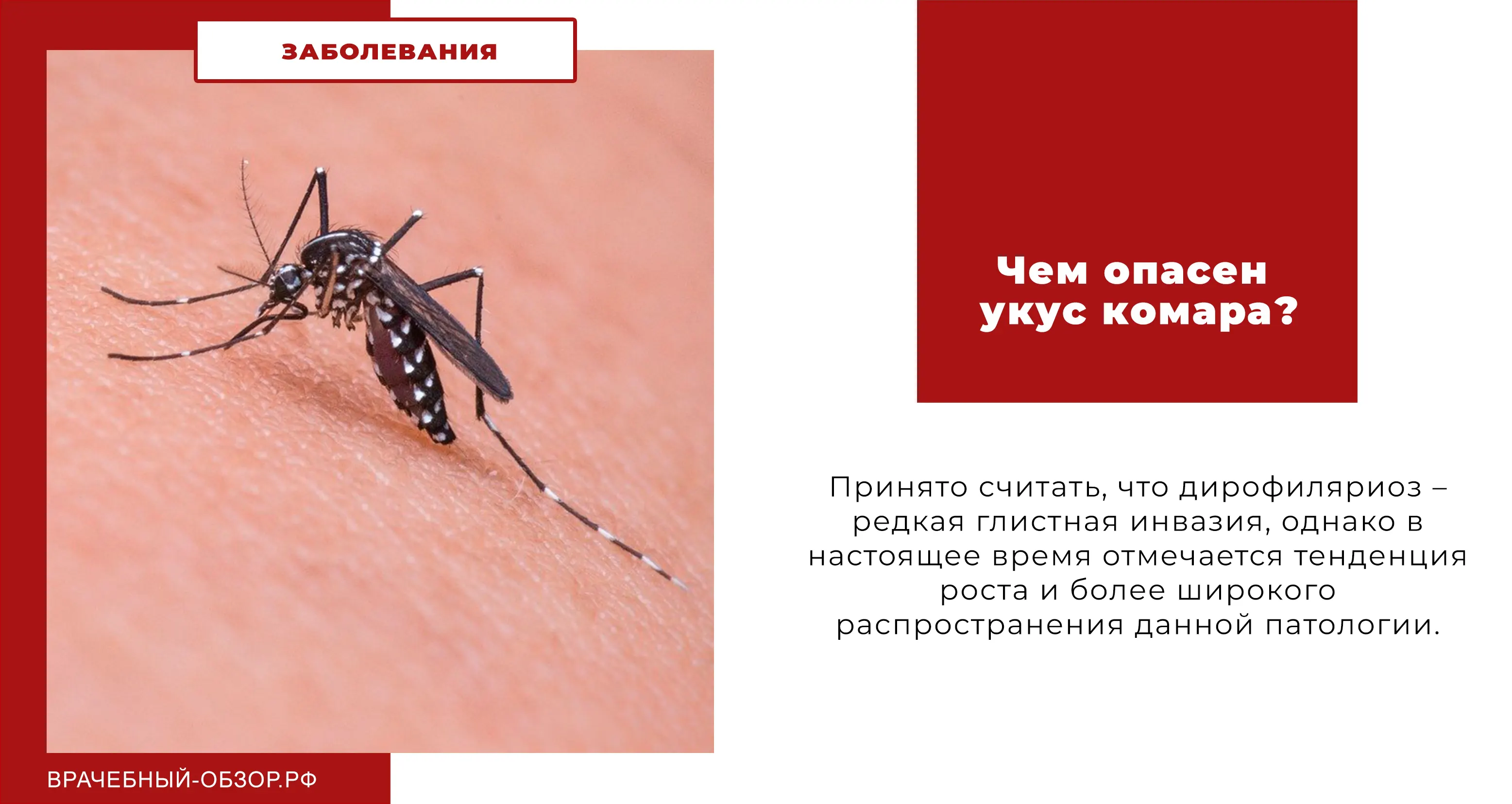 Чем опасен укус комара?