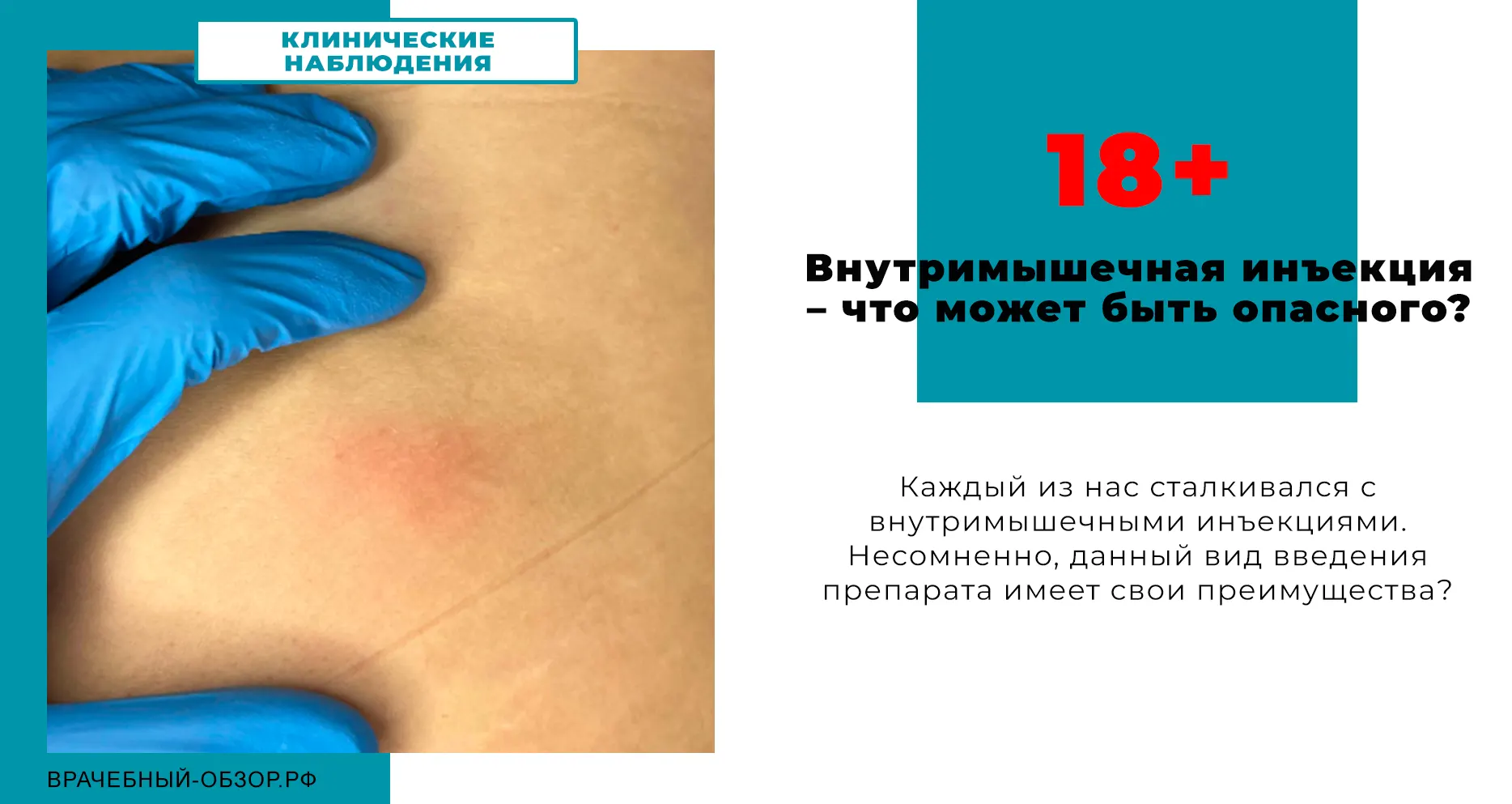 Внутримышечная инъекция – что может быть опасного?